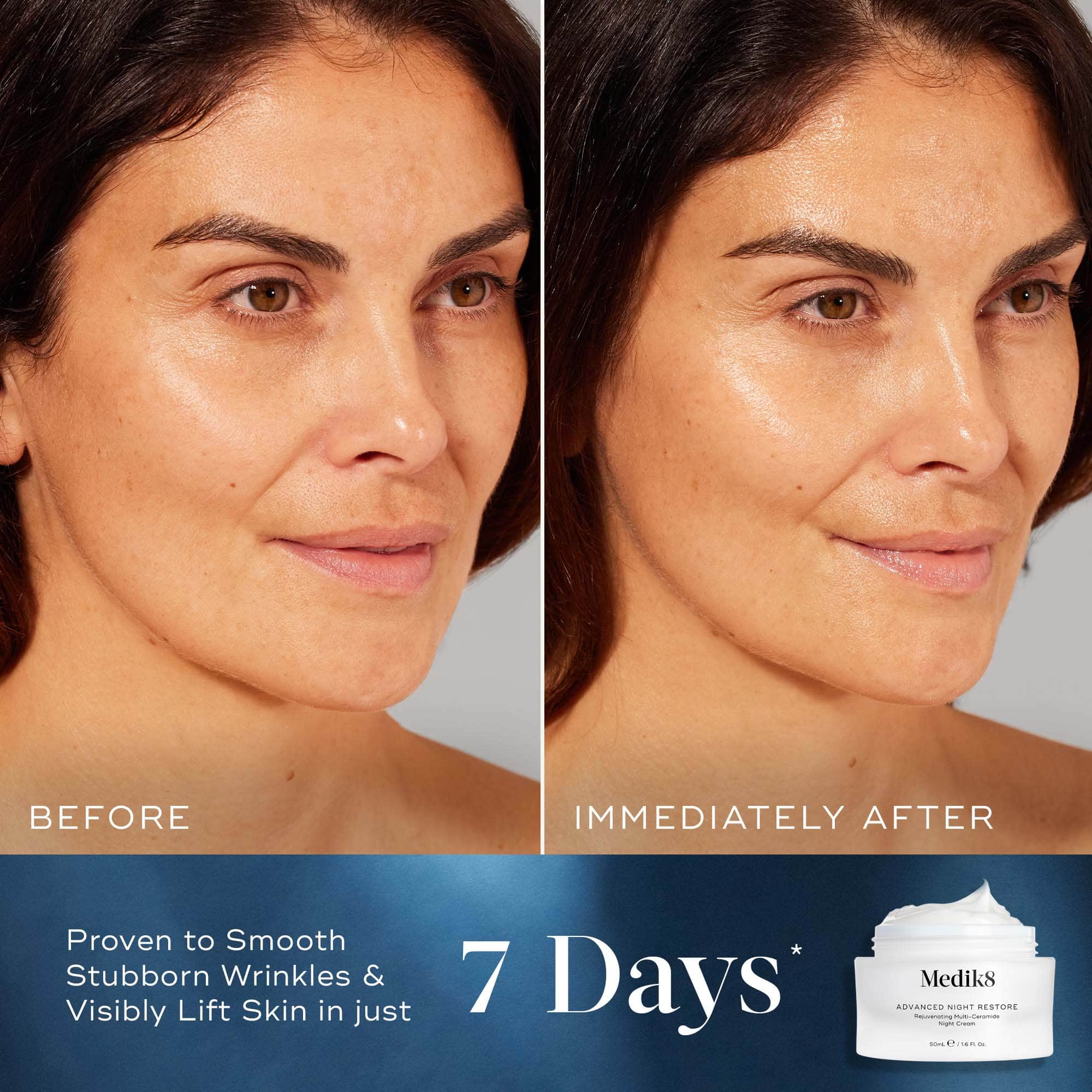 Advanced Night Restore™ - Image 4