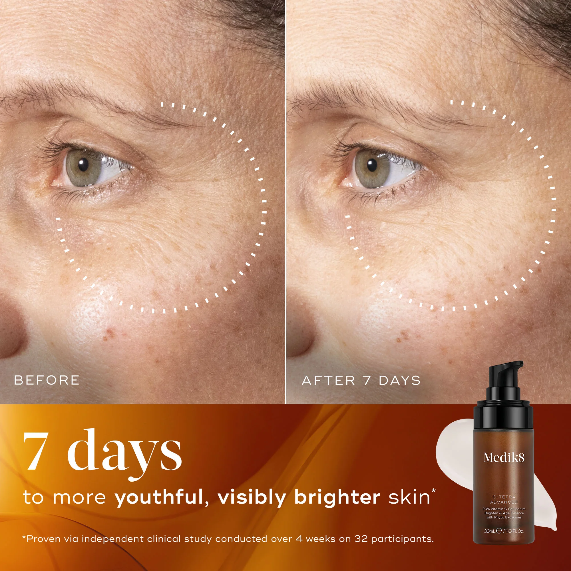 C-Tetra® Advanced - Image 7