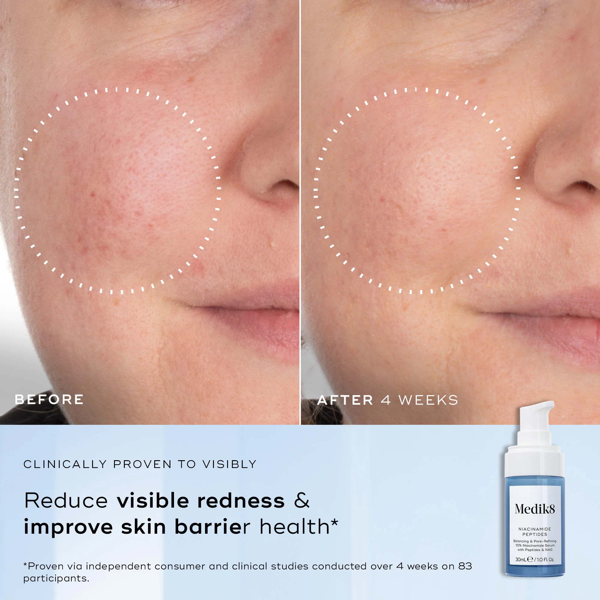 Niacinamide Peptides - Image 4