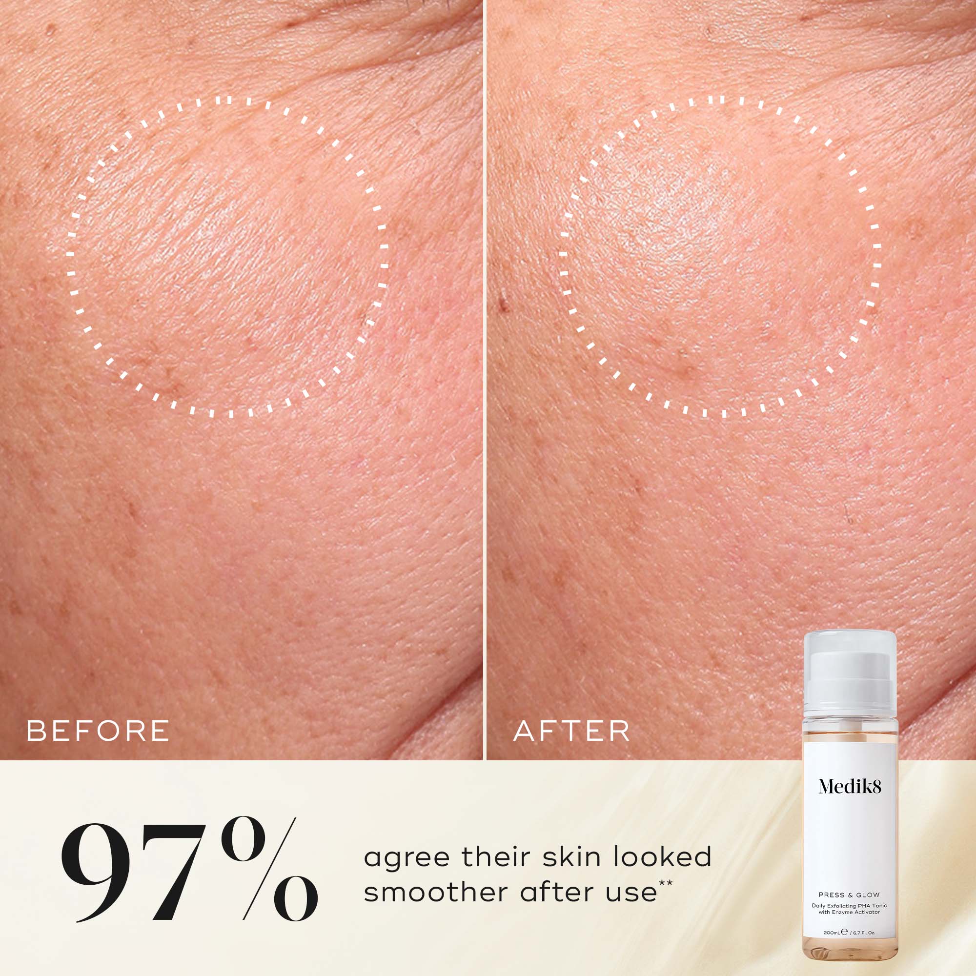 Press & Glow Refill® - Image 4