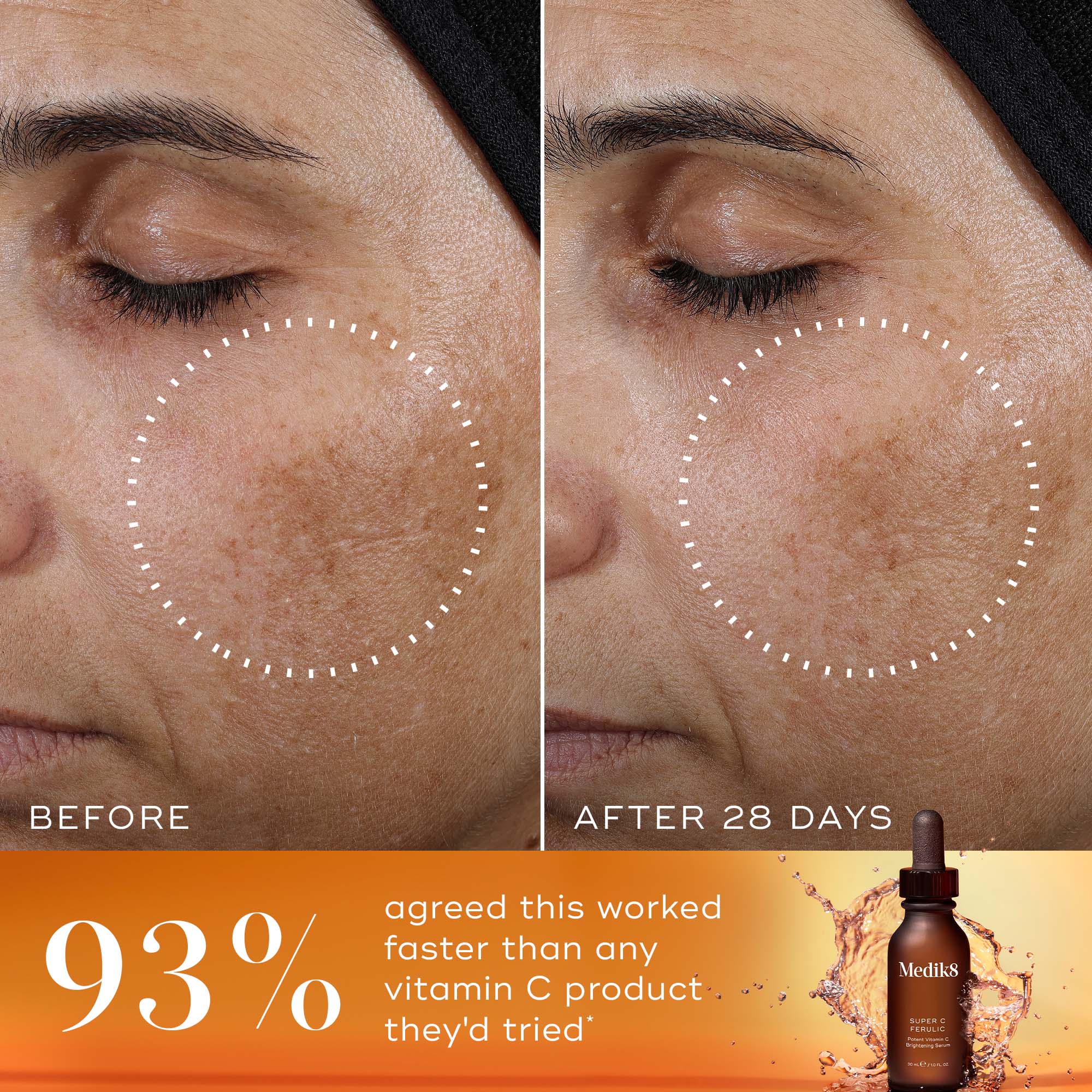 Super C Ferulic™ - Image 3