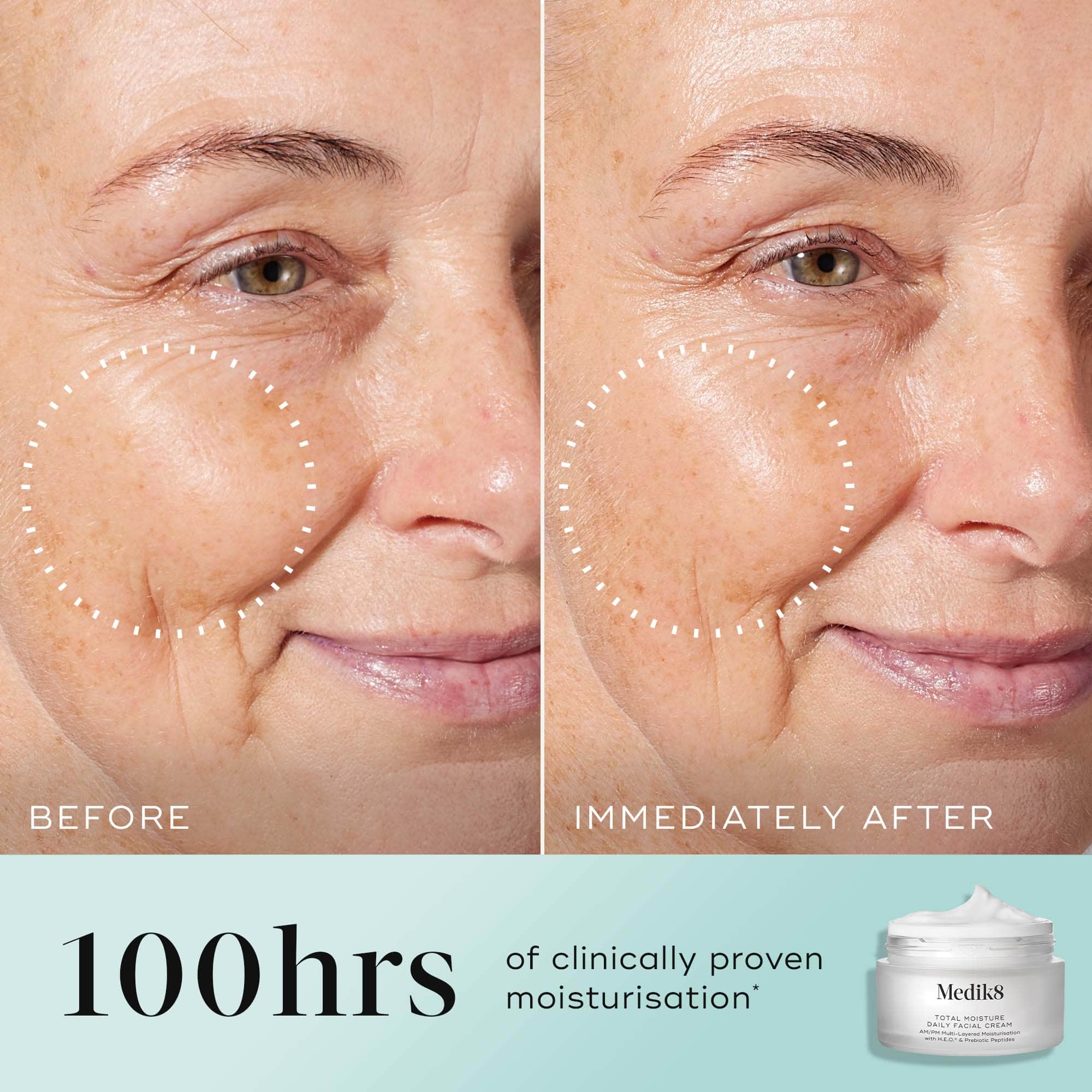 Total Moisture Daily Facial Cream Refill™ - Image 5